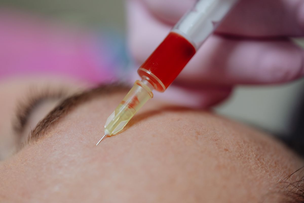 泗水玻尿酸填充剂怎么选：分子量、交联度与注册证解读